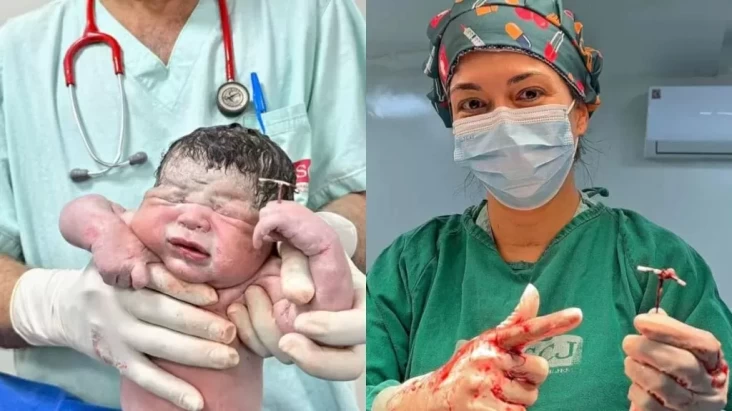 Viral! Bayi Lahir Sambil Pegang IUD yang Gagal Cegah Kehamilan